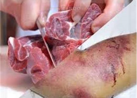 مردم گوشت و محصولات دامی را از فروشگاه‌های مجاز تهیه کنند / تب خونریزی دهنده کریمه کنگو را جدی بگیریم