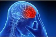 سکته مغزی را با این علائم هشداردهنده بشناسید