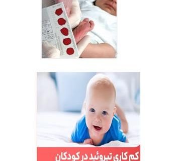از عقب ماندگی ذهنی ۸۹۲ نوزاد در کرمانشاه پیشگیری شد