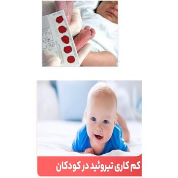از عقب ماندگی ذهنی ۸۹۲ نوزاد در کرمانشاه پیشگیری شد