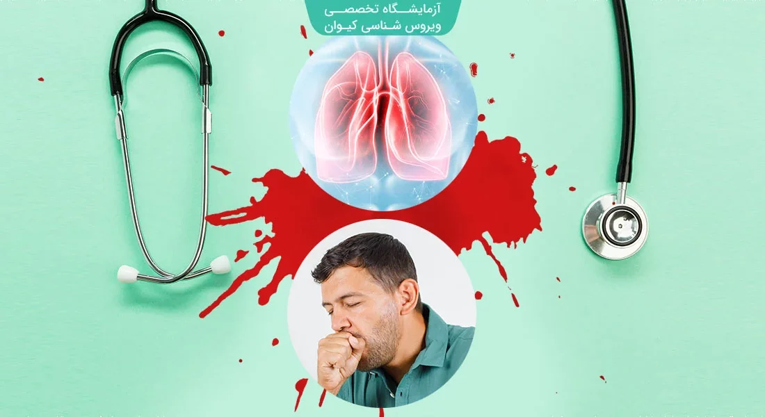 اگر بیشتر از ۲ هفته سرفه کردید، به «سِل» فکر کنید