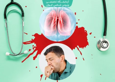 اگر بیشتر از ۲ هفته سرفه کردید، به «سِل» فکر کنید